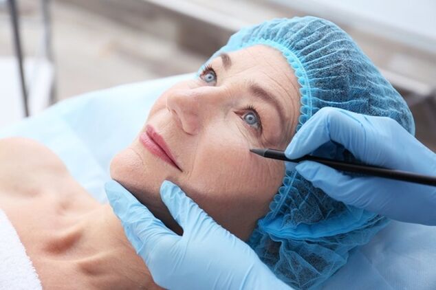 Chuẩn bị cho quy trình căng da mặt không phẫu thuật